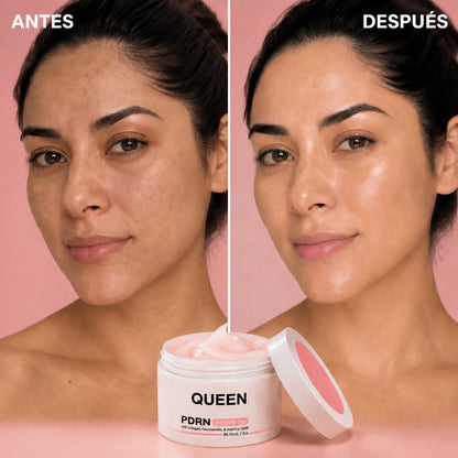 QUEEN Gel de Péptidos PDRN